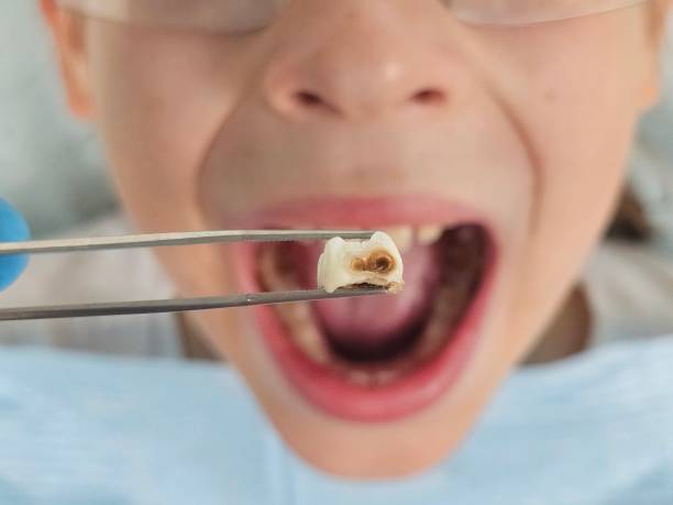 Best Weekend Emergency Dentist in Sandston, VA